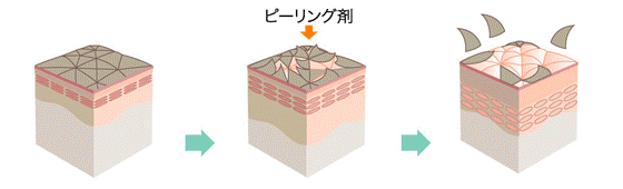ピーリング